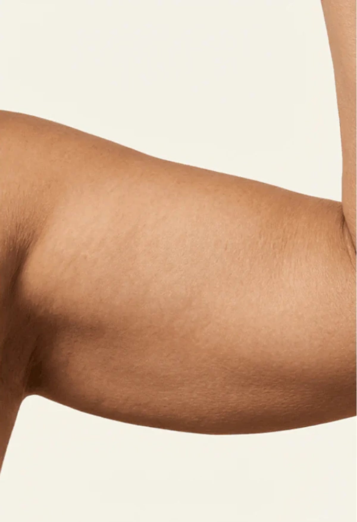 After view of the supplied upper-arm skin comparison