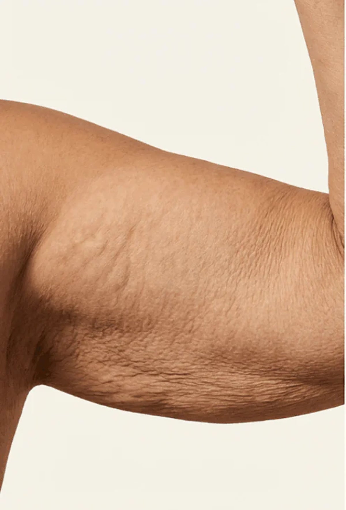 Before view of the supplied upper-arm skin comparison