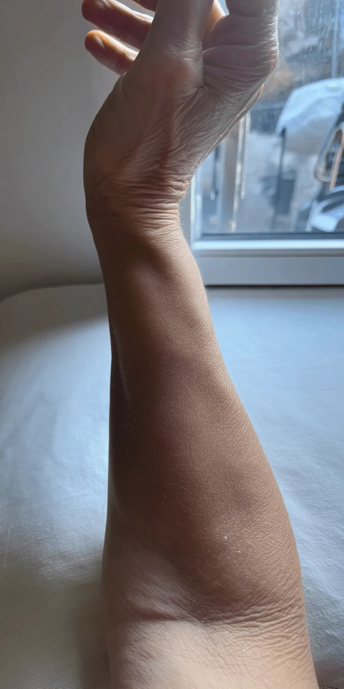After view of the supplied forearm skin comparison