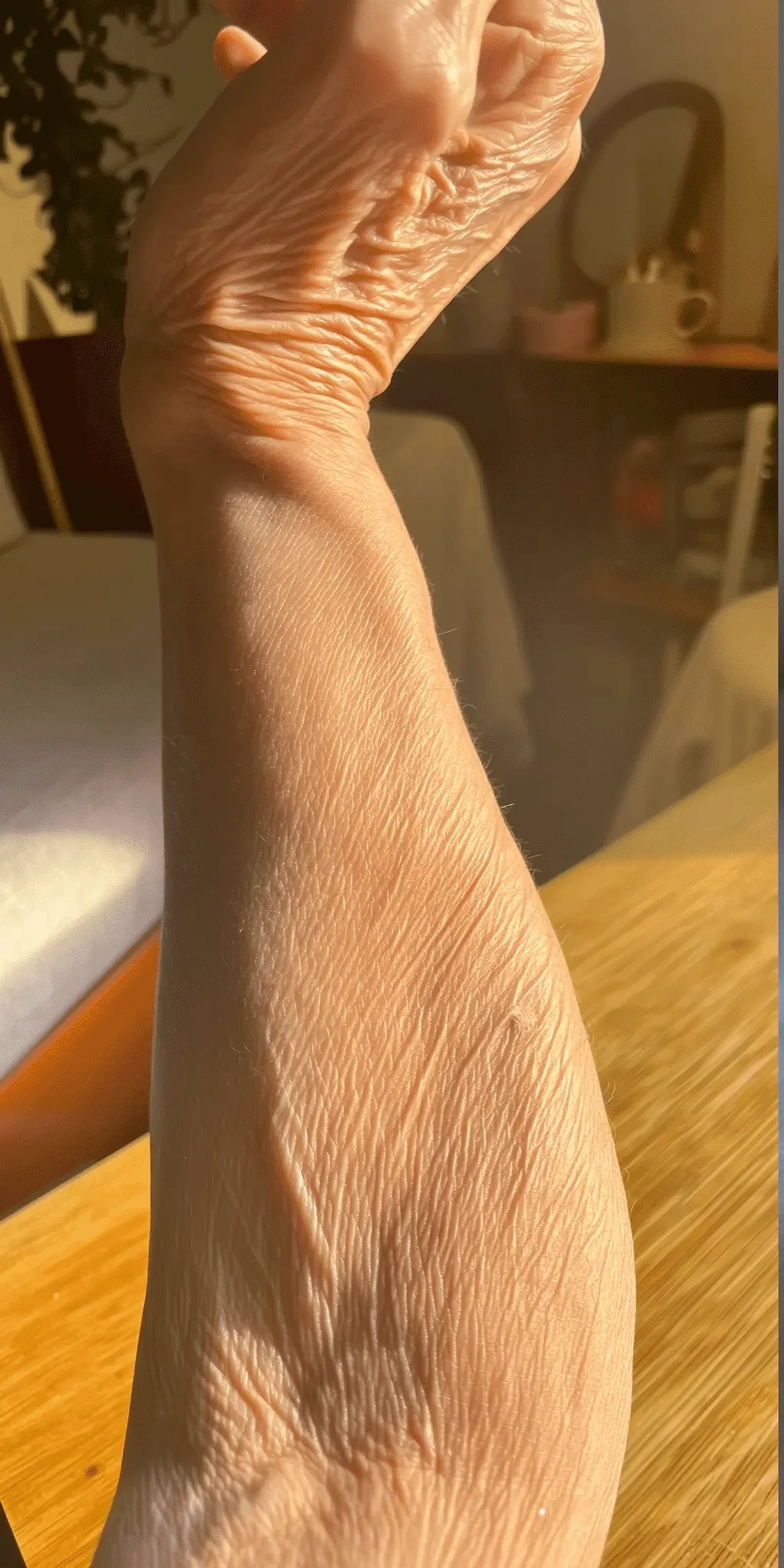 Before view of the supplied forearm skin comparison